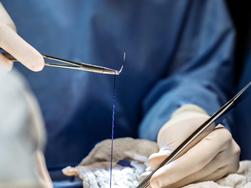Plus Suture Image
