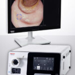 Pentax Medical INSPIRA™ GI Video Endoscope Stack - Endoscopy