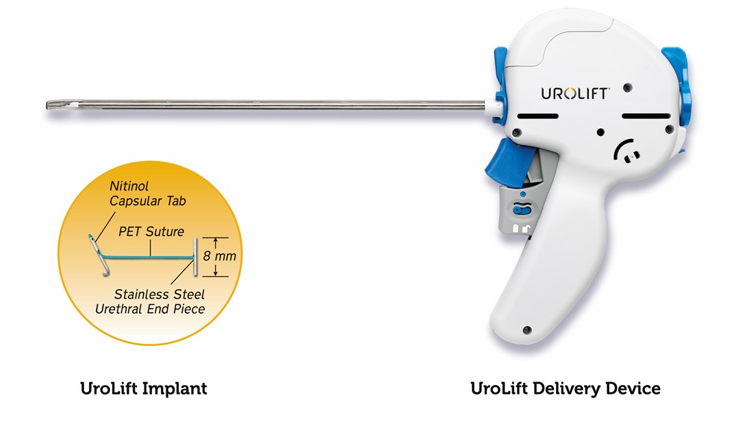 Urolift Device