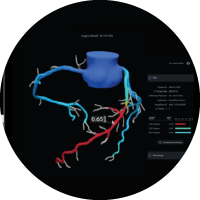 3D image of a heart with the HeartFlow FFR-CT Analysis