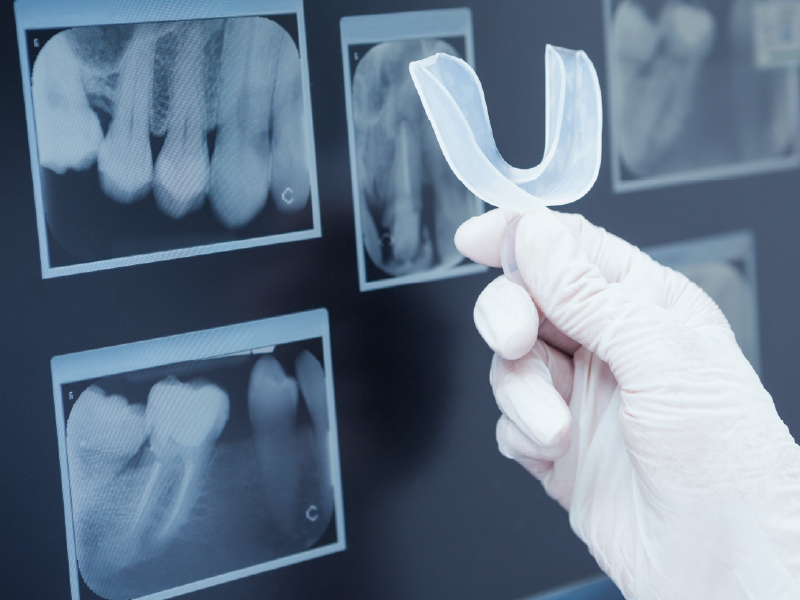 Dental technology xray teeth image Dental technology xray teeth image
