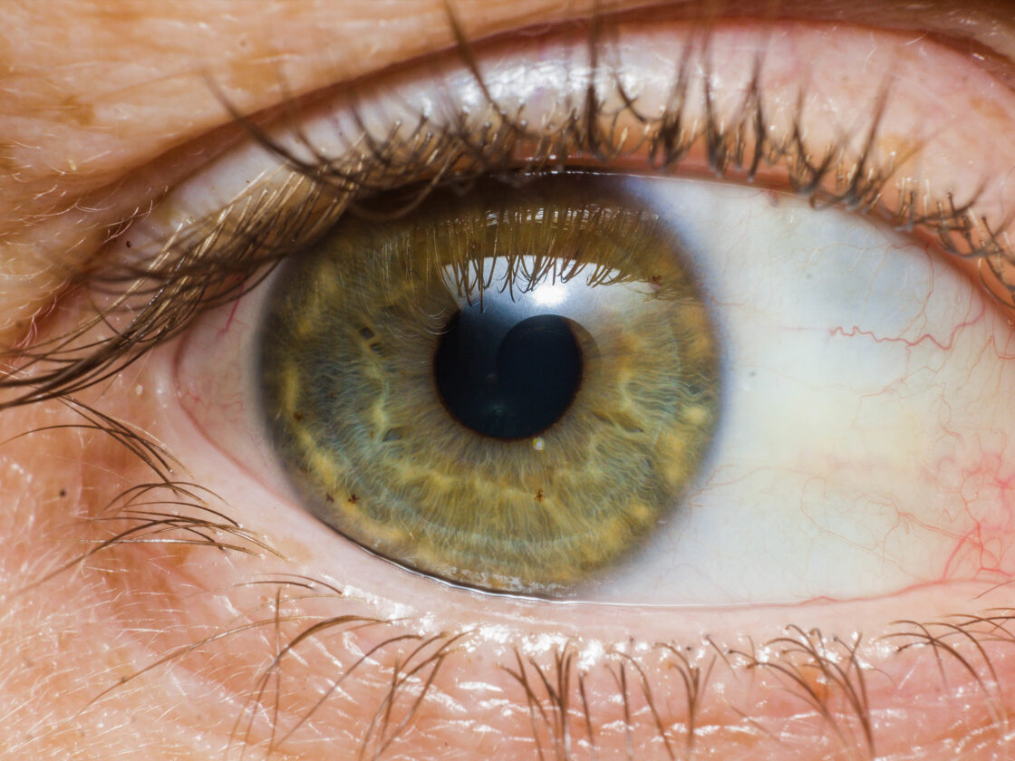 Picture of human eye - link to Ophthalmology Guide