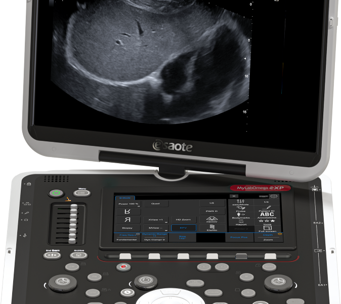 Esaote MyLab™Omega eXP - Ultrasound