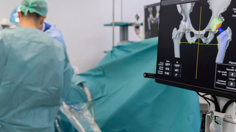 Patient surgery hip arthroplasty replacement osteoarthritis operating room