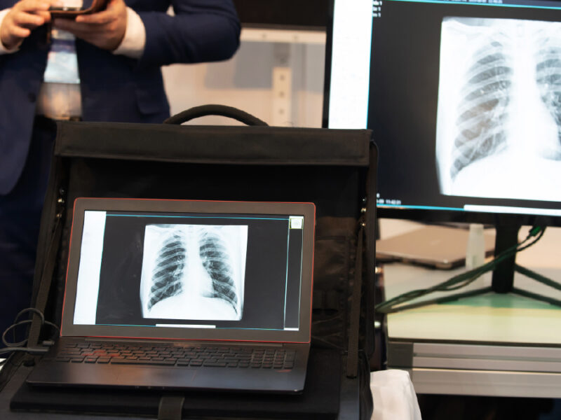 Portable Xray Equipment