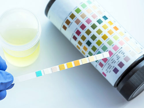 Reagent Strip for Urinalysis