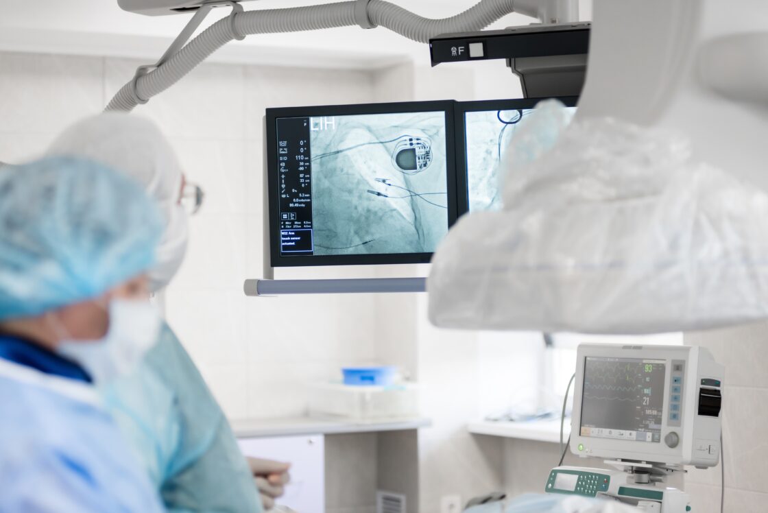 A,Cardiac,Surgeon,In,The,Operating,Room,,Observes,On,X-ray