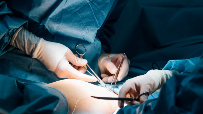 Click to access this case study on suture switch