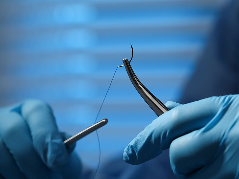 Surgeon - forceps - suture - thread